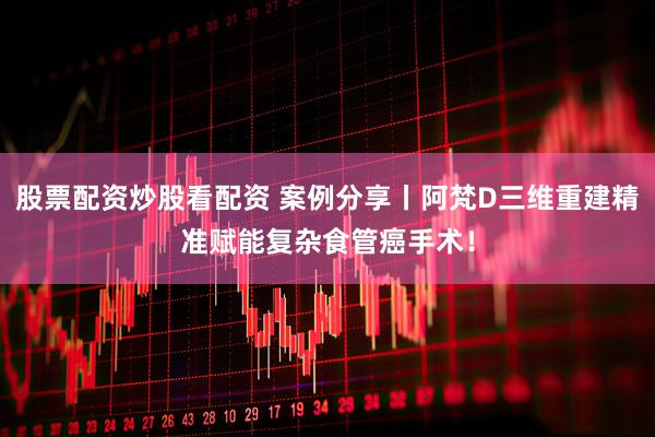 股票配资炒股看配资 案例分享丨阿梵D三维重建精准赋能复杂食管癌手术！